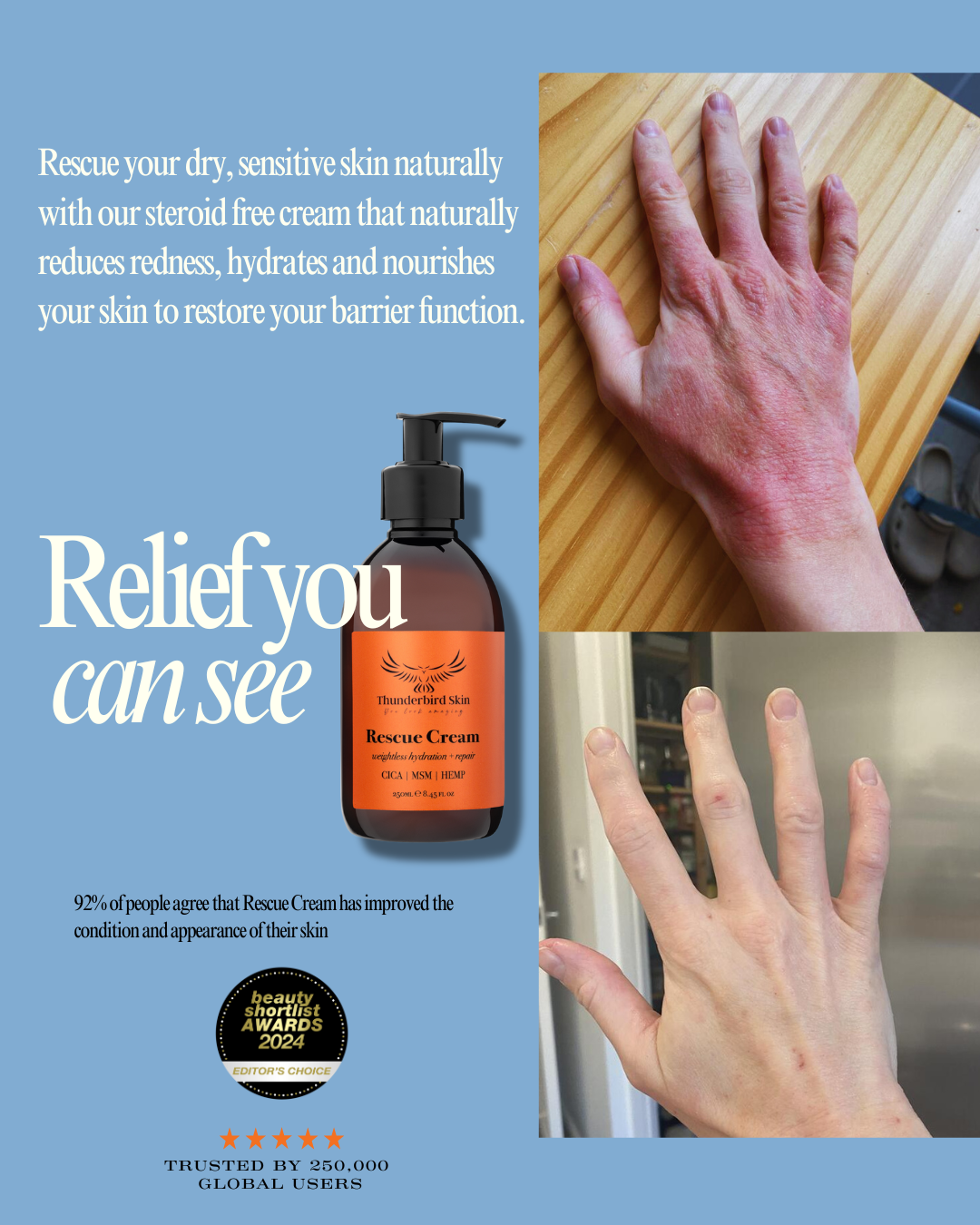 Rescue Cream