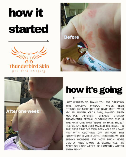 Skin Calming Tonic