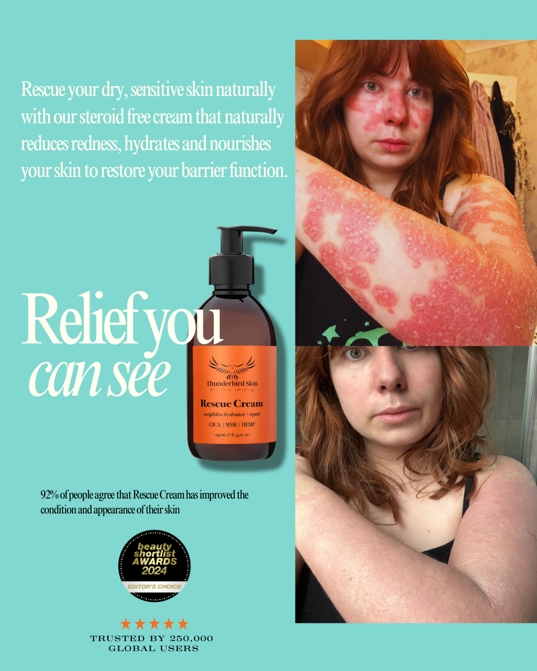 Rescue Cream