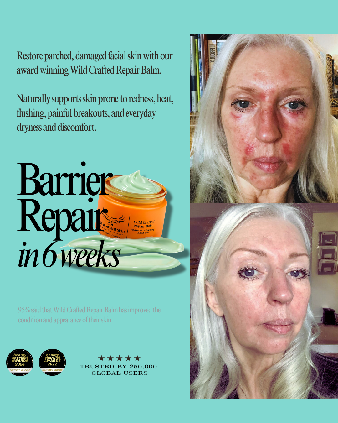 Redness Relief