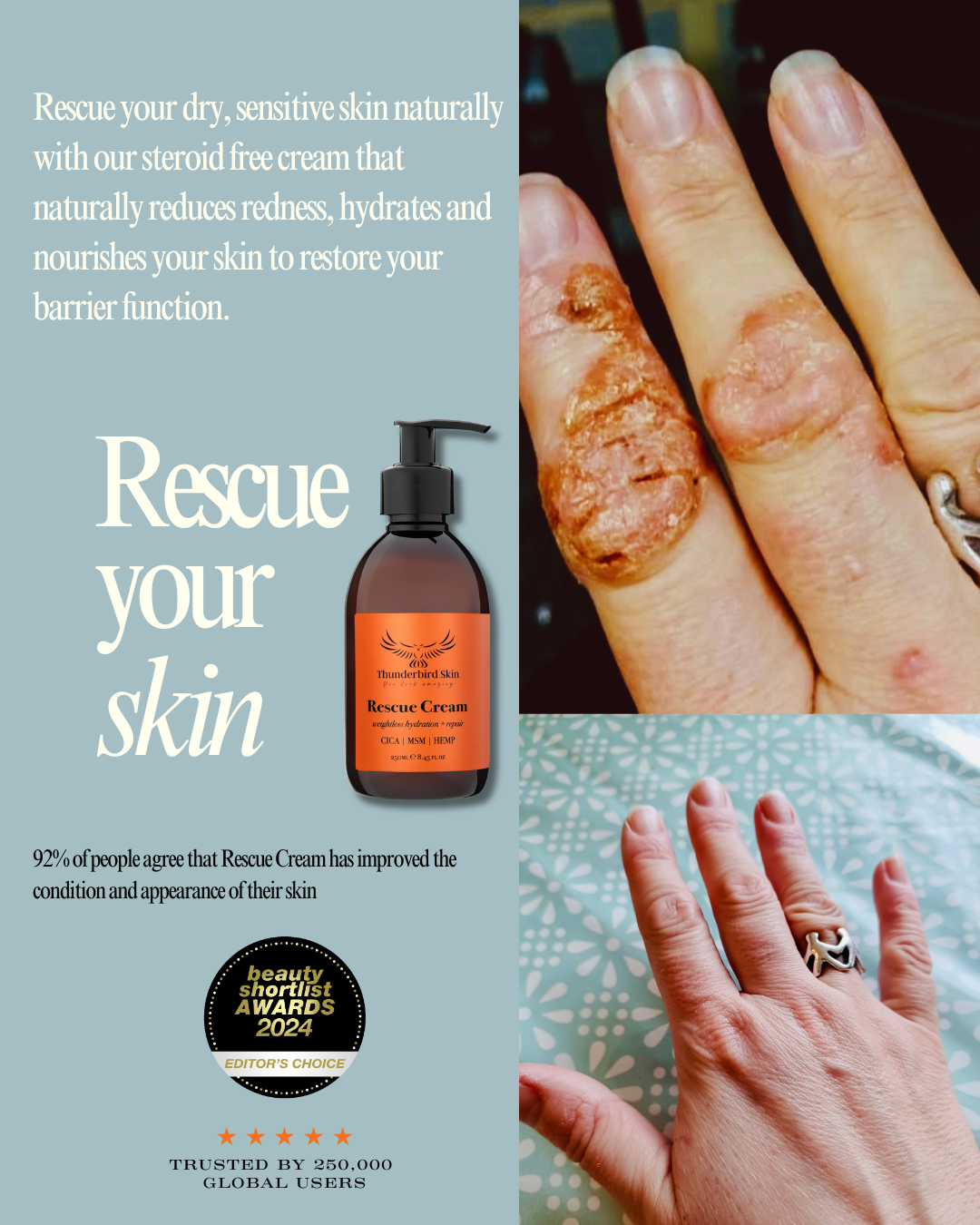 Rescue Cream