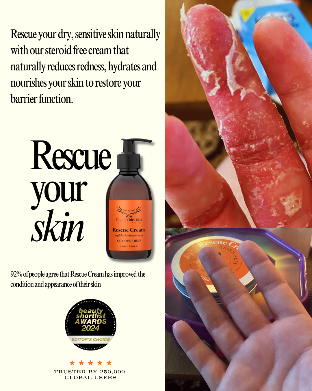 Rescue Cream